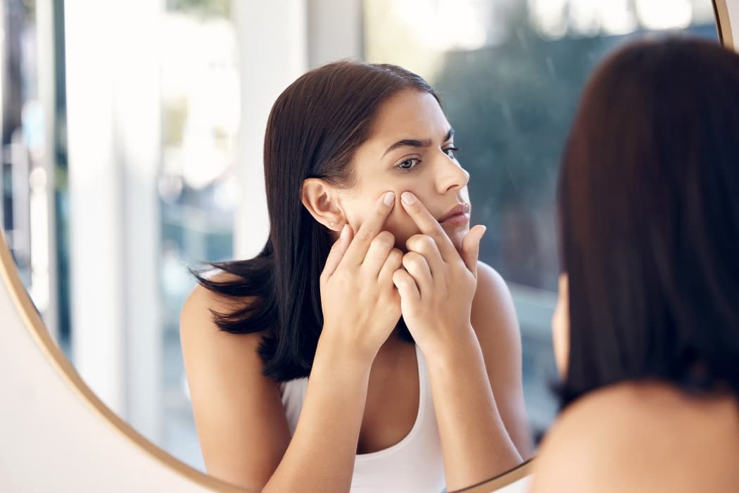 online dermatologist for acne