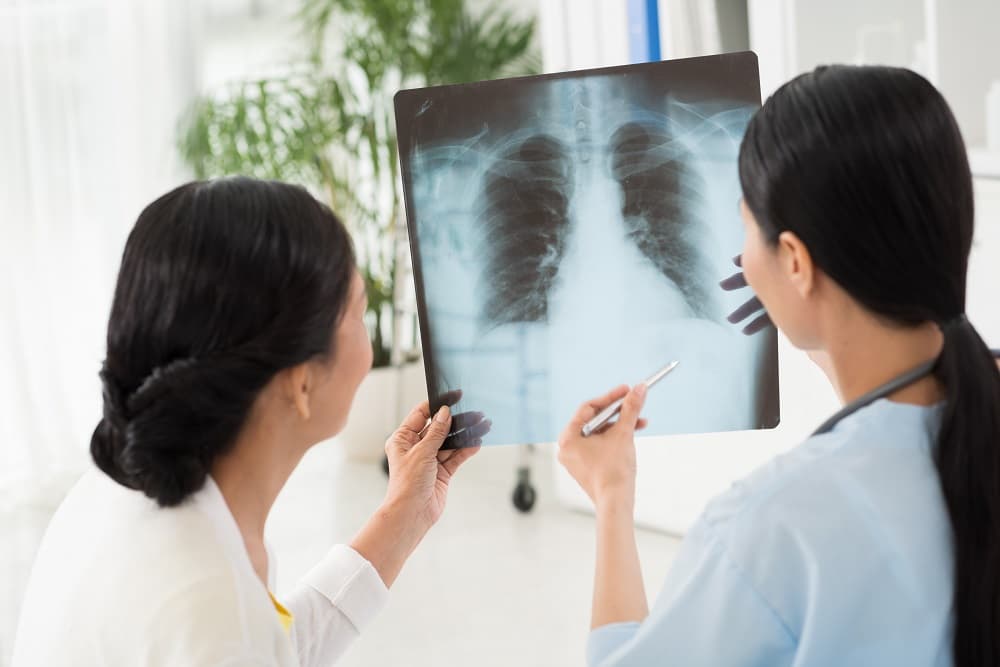 Causes of Bronchitis