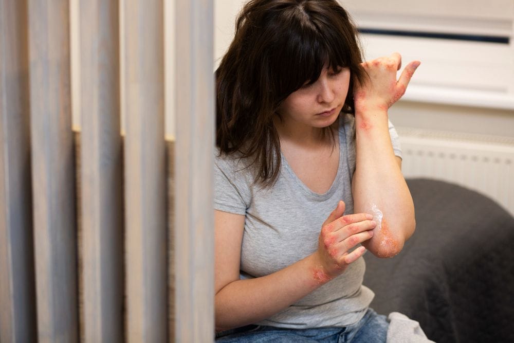 Itching for Scabies Treatment? Discover Online Solutions and Benefits - 24hrdoc